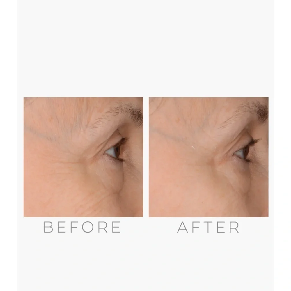 GloPro Skincare Tool -‎ White and Pink